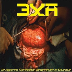 Olivoponto-Cerebellar Degenerative Disease