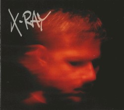 X-Ray