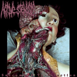 Succumbed to Infection