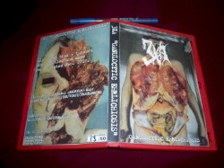 Ganulocytic Ehrlichiosis