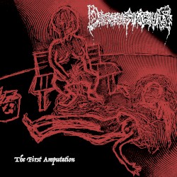 The First Amputation