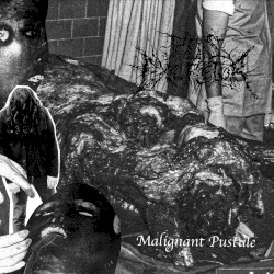 Malignant Pustule - Demo 2025