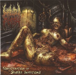 Concatenation of Severe Infections