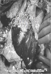 Ovarian Liquefaction