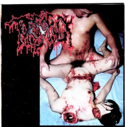 Disgusting Gore And Pathology / Polymorphisms To Severe Sepsis In Trauma