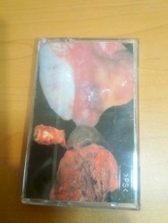 Cadaverjelly Saponification / Black Market Organ Donor