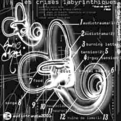 Les Crises Labyrinthiques