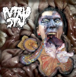 Amidst an Anal-Analgesic Assembly