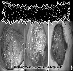 Impacted Bowel Banquet