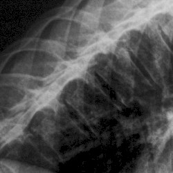 Phantom, the Monstruous Lamentation