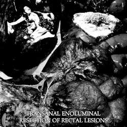 Transanal Enoluminal Resection of Rectal Lesions
