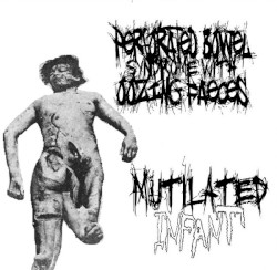 Perforated Bowel Syndrome With Oozing Faeces / Mutilated Infant