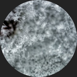 Repetitive Behaviors