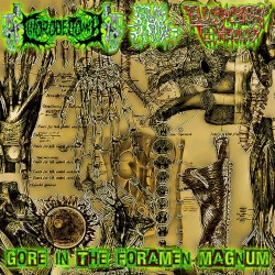Gore In the Foramen Magnum