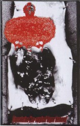 Transuterine Non-Surgical Organ Removal