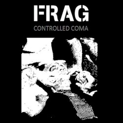 Controlled Coma