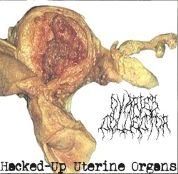 Hacked-Up Uterine Organs
