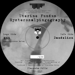 Hysterosalpingography