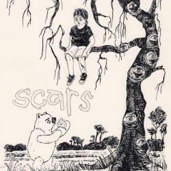 Scars