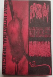 4 Way Intestinal Infection