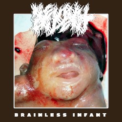 Brainless Infant