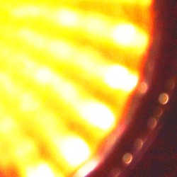 Intolerable Photosensitivity