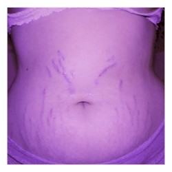 Diet Culture (stripped)